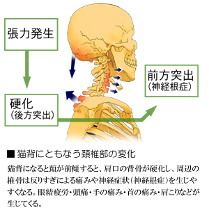 �L�w�ƌz�ŕ��̊֐߈ُ�