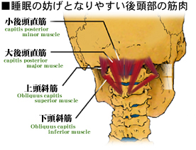 �����̖W���ƂȂ�㓪�|�،Q