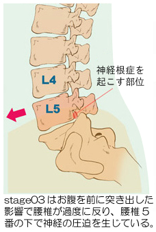 ���ł̂��ׂ�ɂ��_�o����