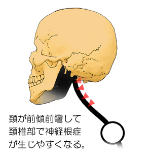 stage04�̎p���ƌz���̌�]