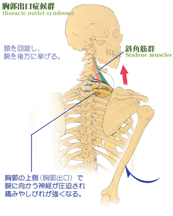 ���s�o���ǌ�Q�̌����@