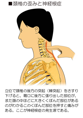 �z�ł̑O�]�Ɛ_�o����