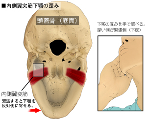 �������ˋ؂̕t�����ʂƎ�ɂ��R���^�N�g
