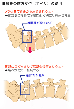 ���ł̂��ׂ�̊ӕʖ@�̍l����