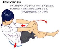 ���ł̂��ׂ�ɂ�鍘�ɂ̑Ώ��@02