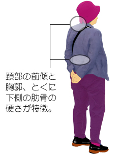 stage04�̎p���̓���