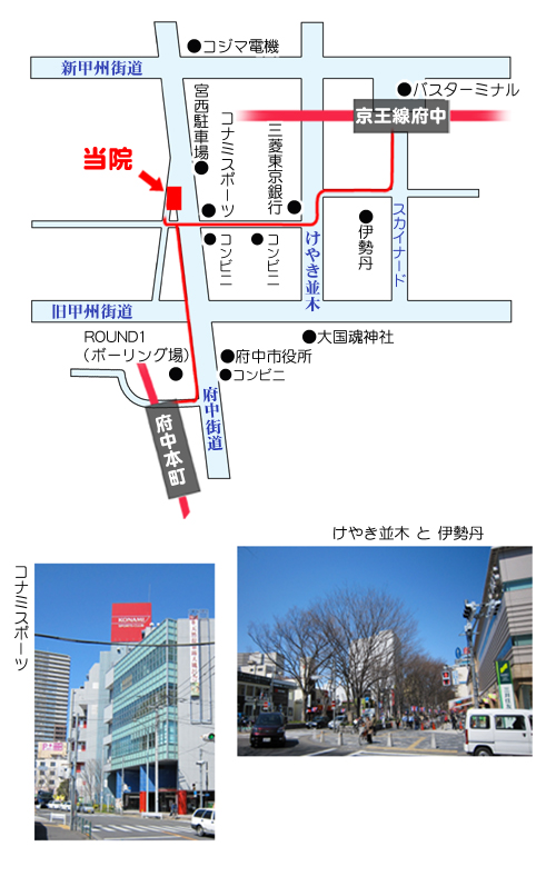 �������{���A�앐���{���{������₷�炬�n�����֎��铹��